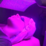 פוטותרפיה לפנים טיפול באקנה ע"י שילוב אור אדום וכחול להבראת העור וחידושו.